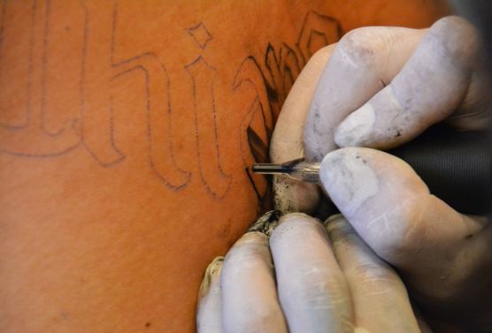 Things You Should Consider When Choosing the Best Tattoo Removal Machine